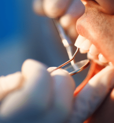 Emergency-Dental-Services