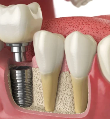 Oral-Dental-and-Maxillofacial-Surgery